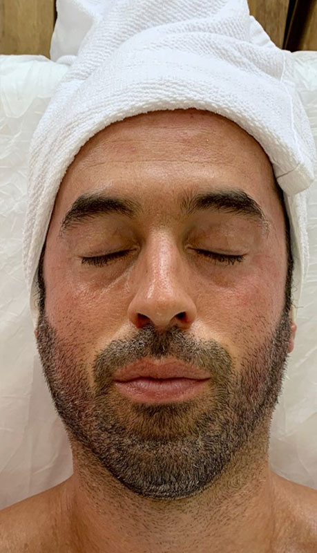 Client after treatment