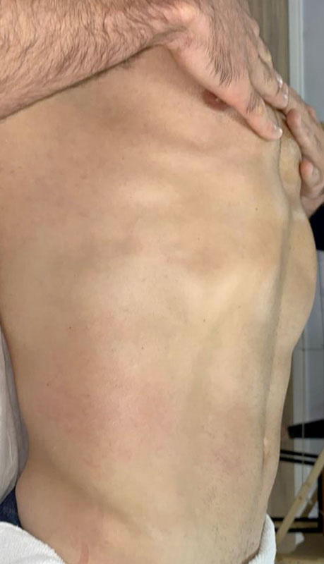 Client before treatment